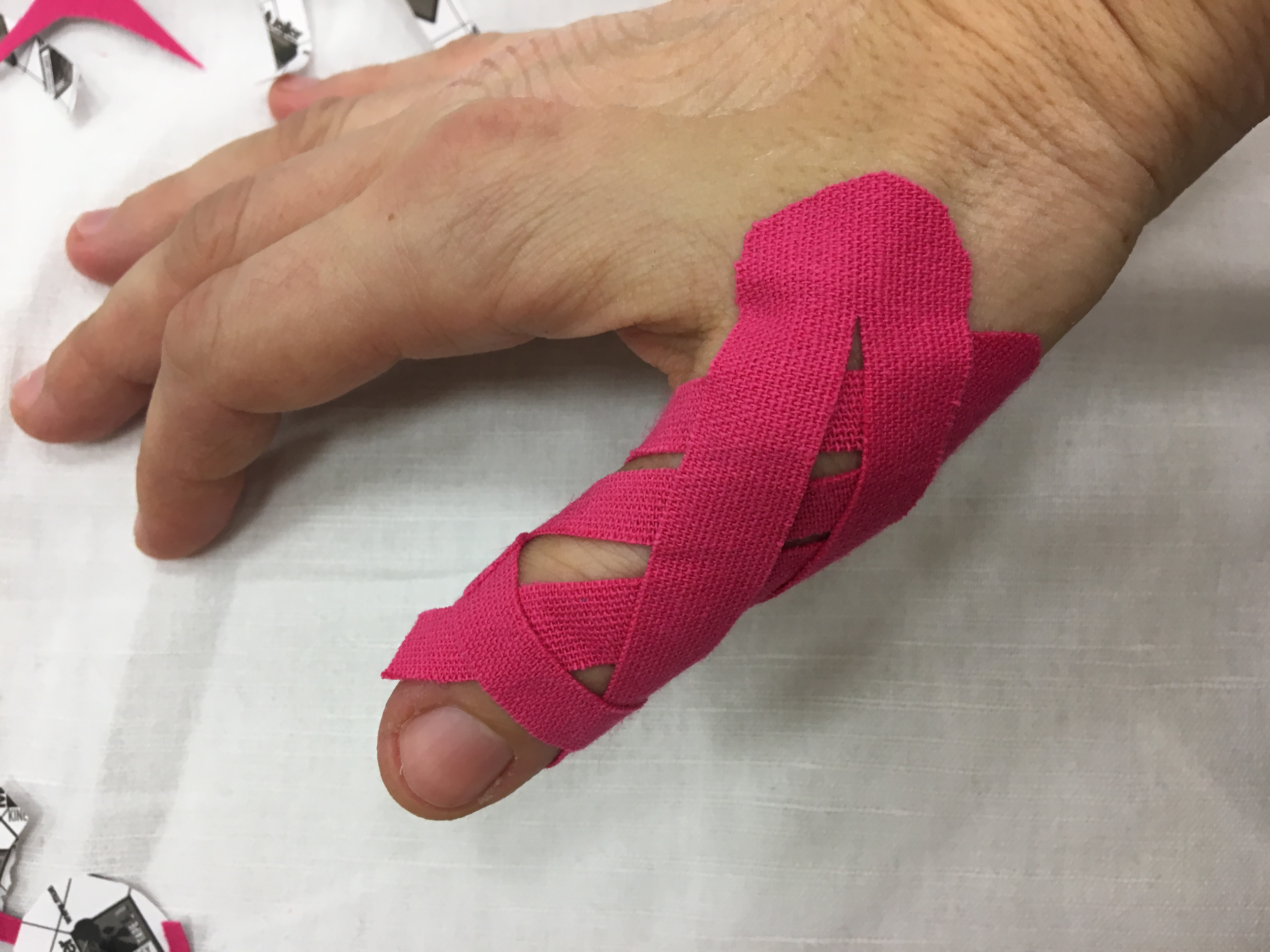 Kineziotaping (kineziotejping)