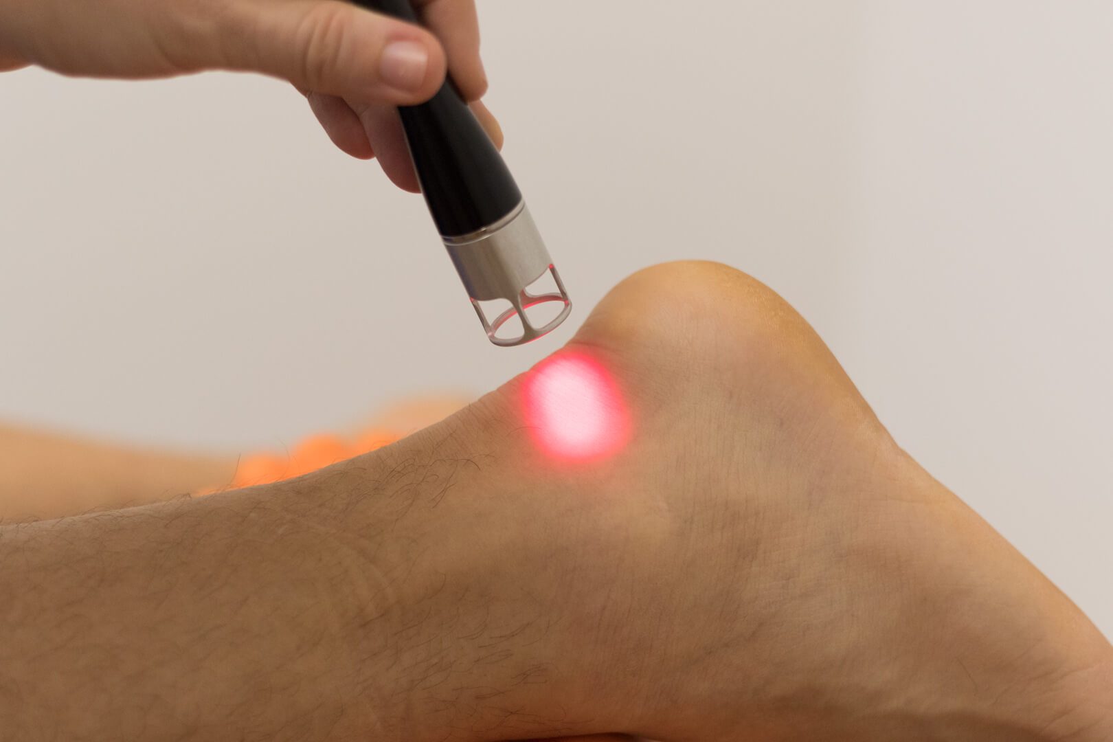 high intensity laser na achillovu šlachu