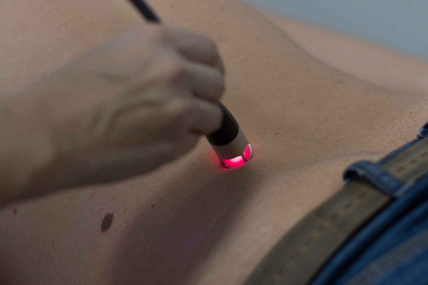 high intensity laser na chrbticu